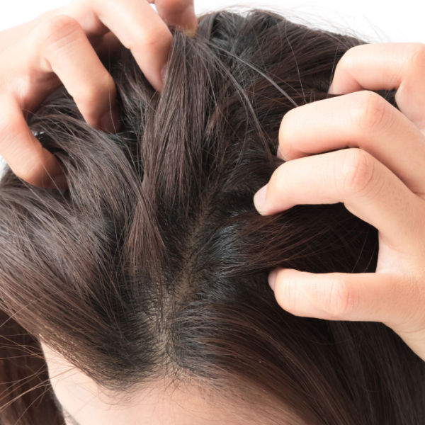 Everything You Need to Know About Scalp Problems