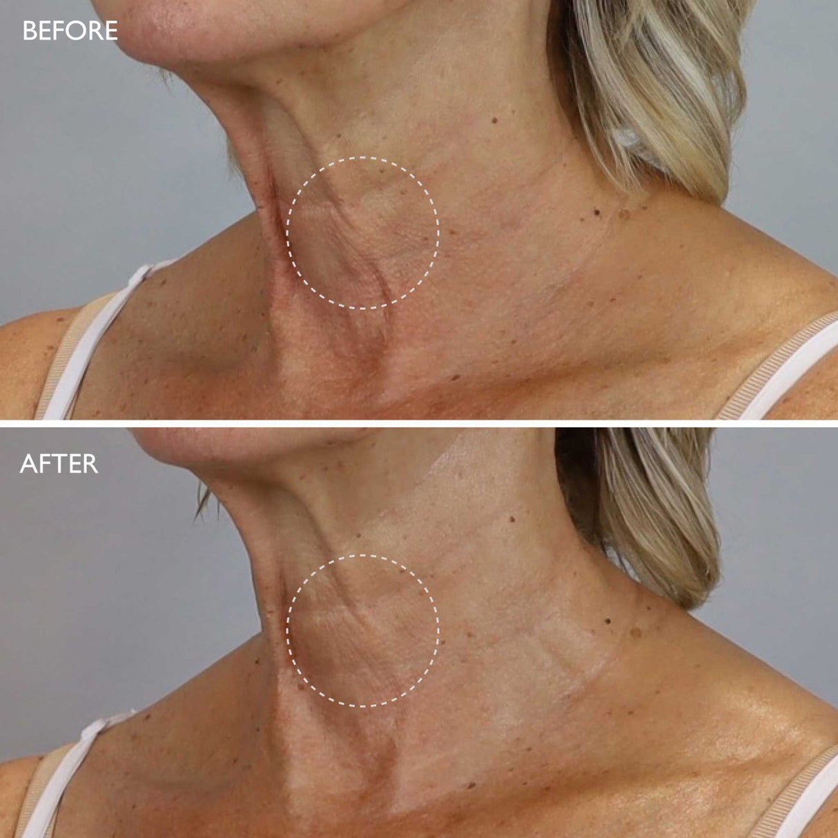 Gatineau AGE BENEFIT Neck & Décolleté Cream 50ml