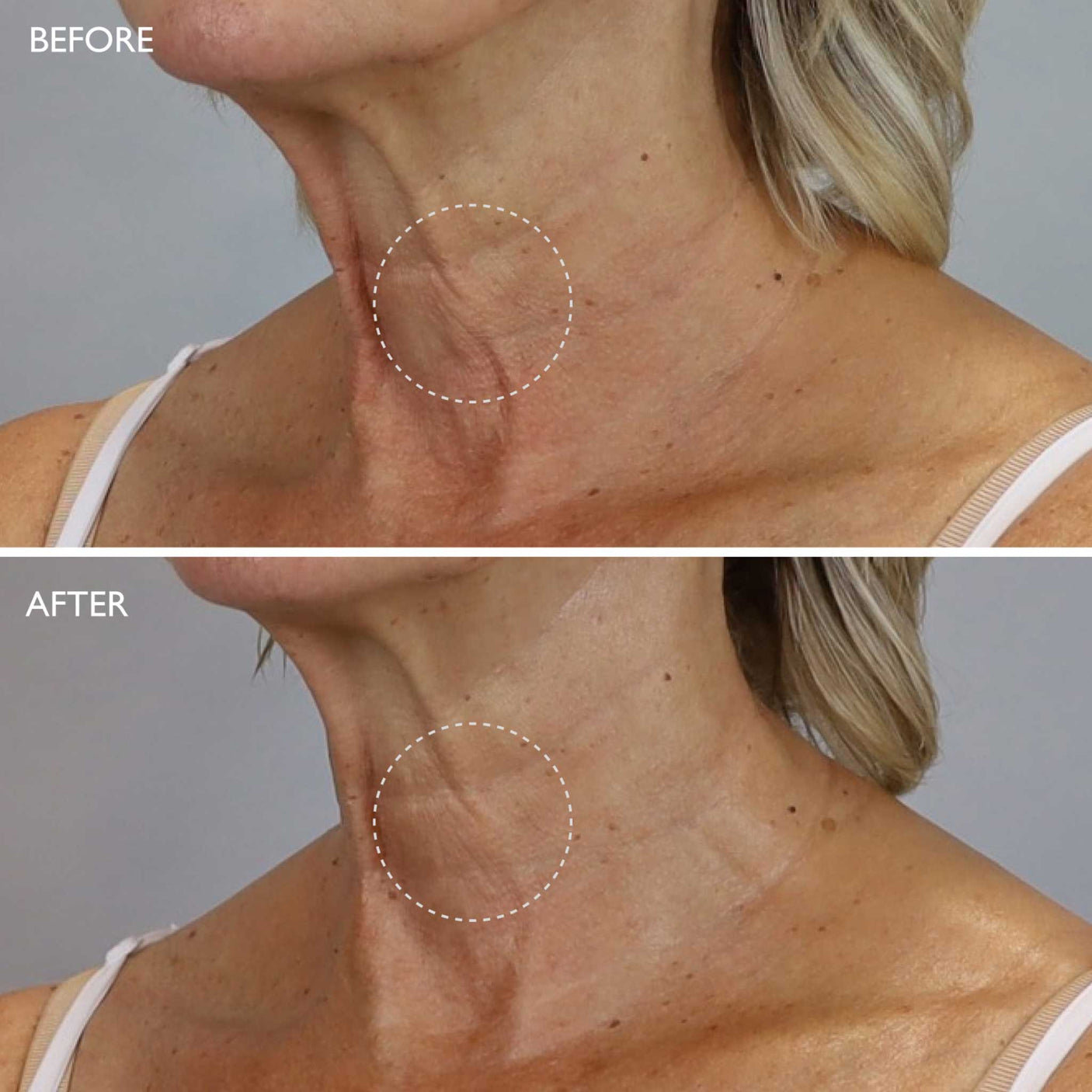 Gatineau AGE BENEFIT Neck & Décolleté Cream 50ml