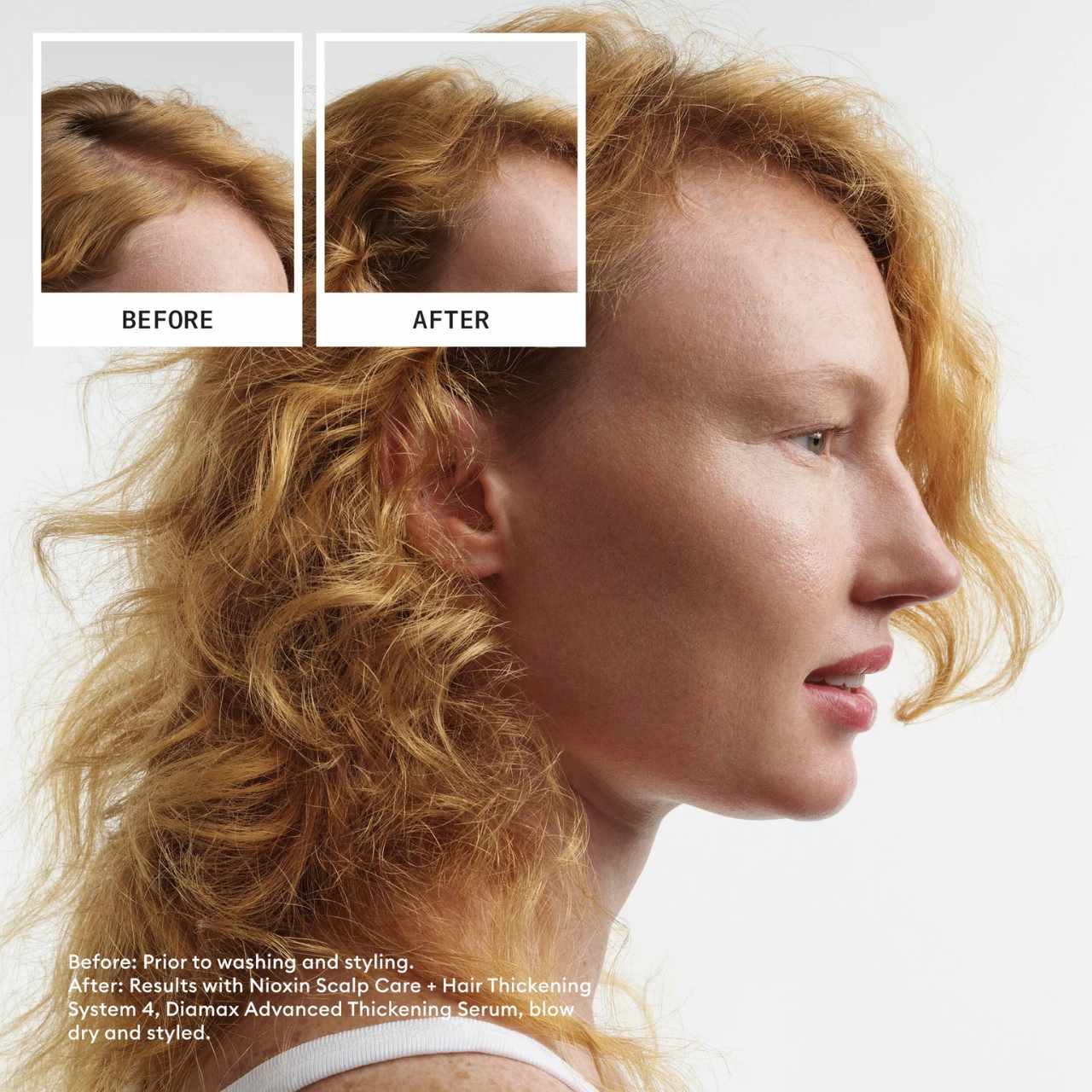 Nioxin System 4 Shampoo & Conditioner Duo