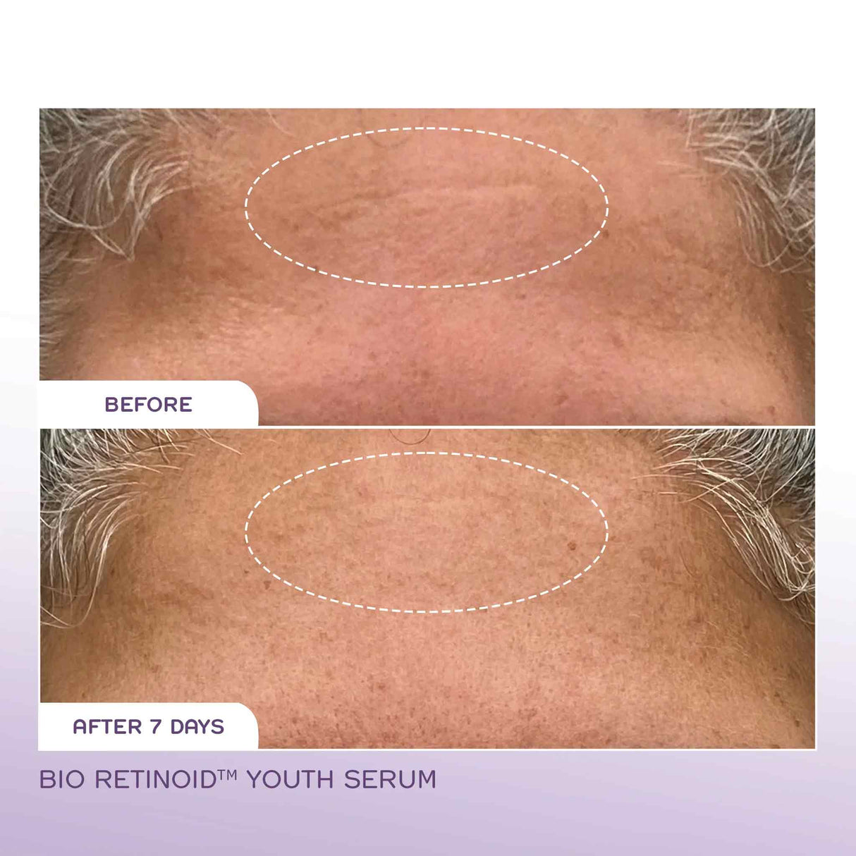 REN Bio Retinoid Youth Serum 30ml