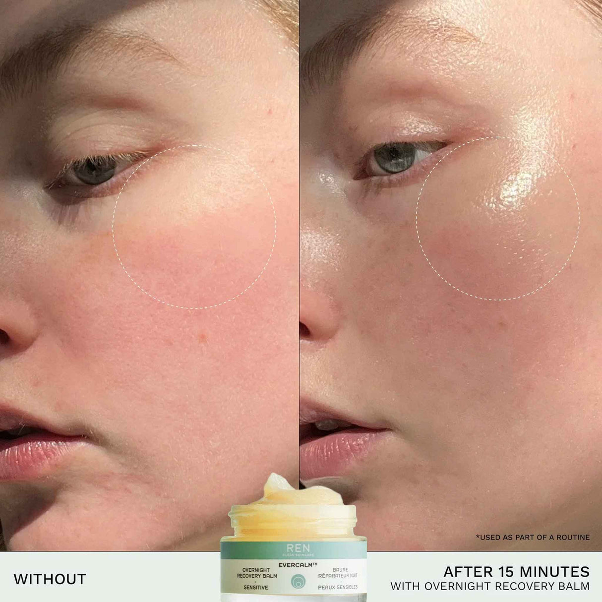 REN EverCalm Overnight Recovery Balm 30ml