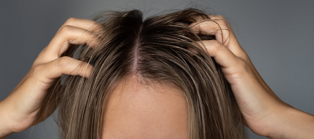 How to Soothe a Sensitive Scalp During Dry South African Winters