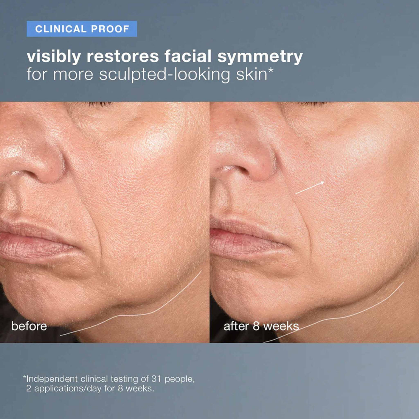 Dermalogica Neurotouch Symmetry Serum 30ml