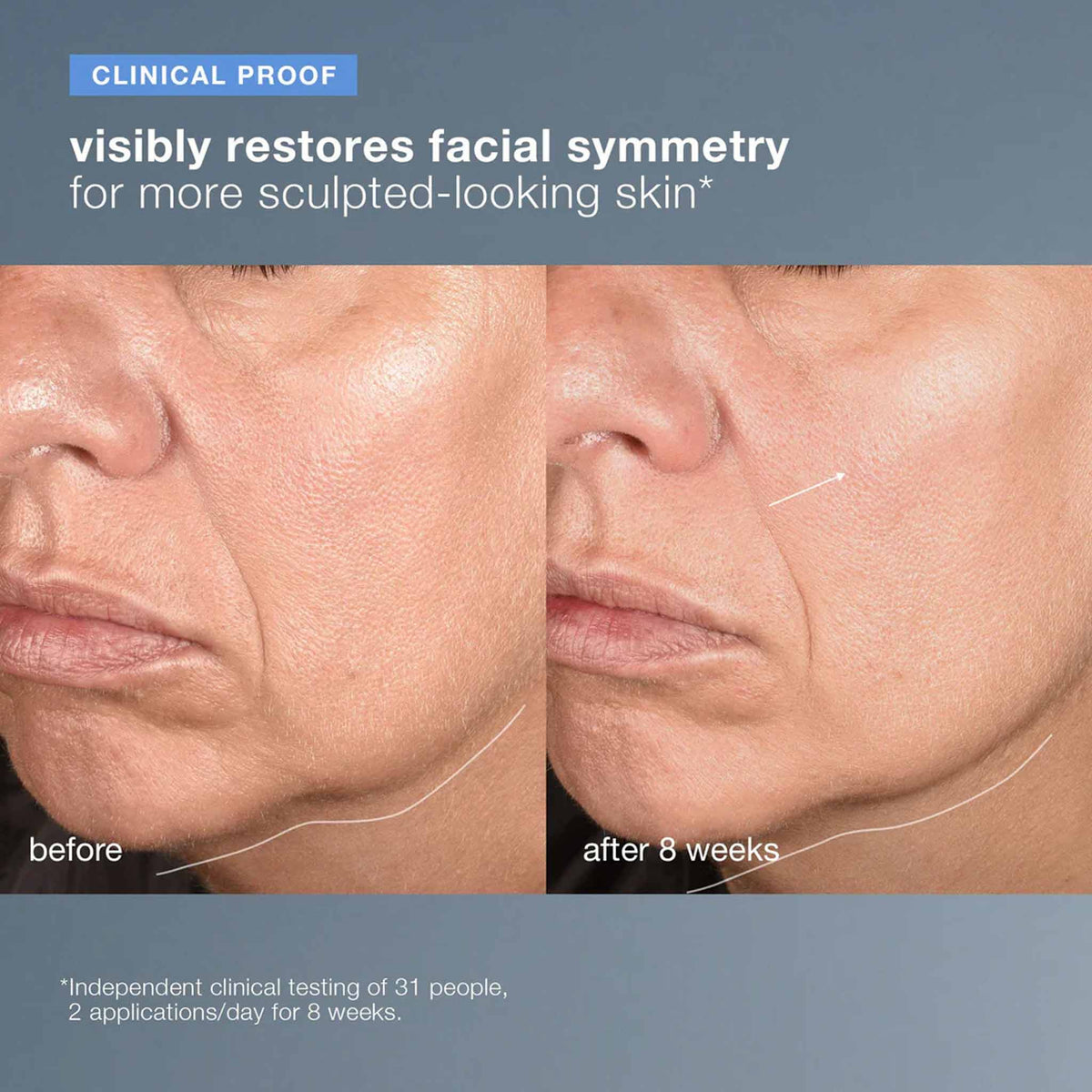 Dermalogica Neurotouch Symmetry Serum 30ml