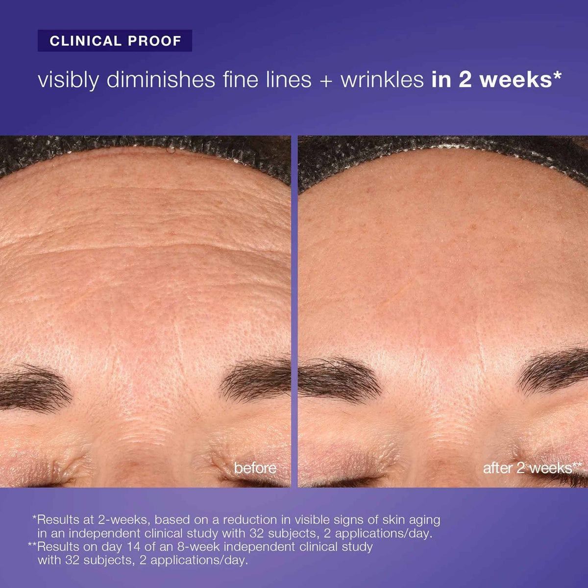 Dermalogica Phyto-Nature Regenerating Daily Exosome Leave-on Treatment 100ml