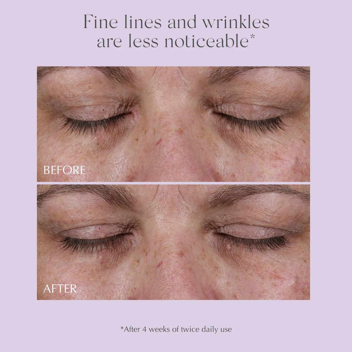 Exuviance Age Reverse Eye Contour 15g