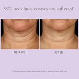 Exuviance Age Reverse Toning Neck Cream 125g