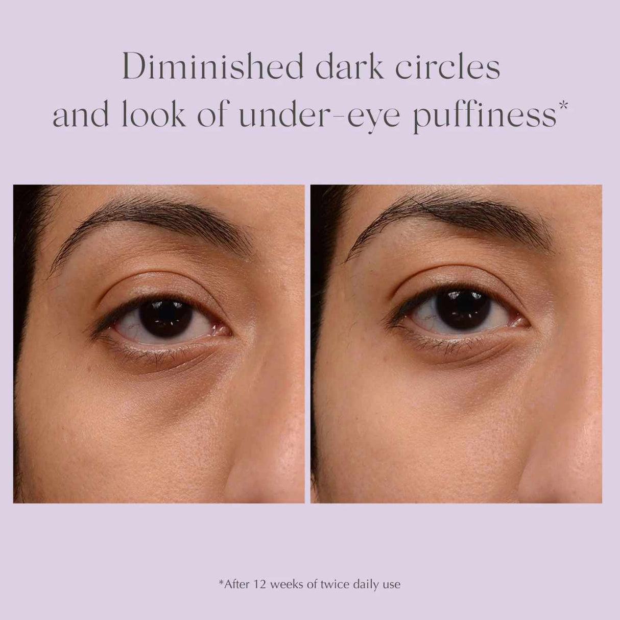 Exuviance Bright Eyes Dark Circle Corrector 15g