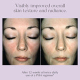 Exuviance Hydrate & Renew Overnight Transformation Complex 50g