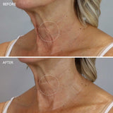 Gatineau AGE BENEFIT Neck & Décolleté Cream 50ml
