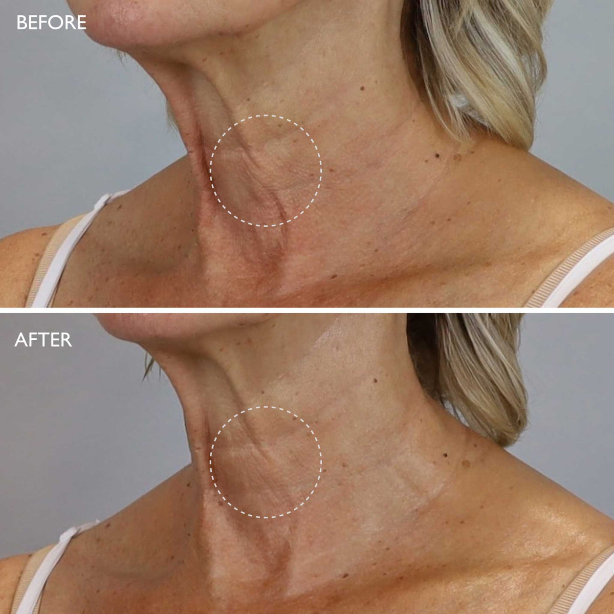 Gatineau AGE BENEFIT Neck & Décolleté Cream 50ml