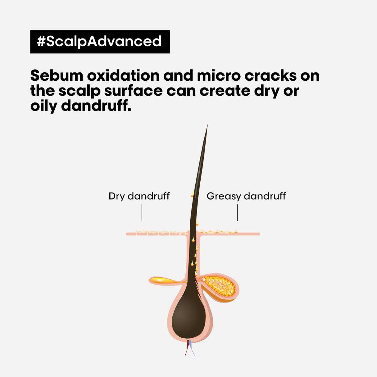 L'Oreal Professionnel Scalp Advanced Anti-Dandruff Shampoo 300ml