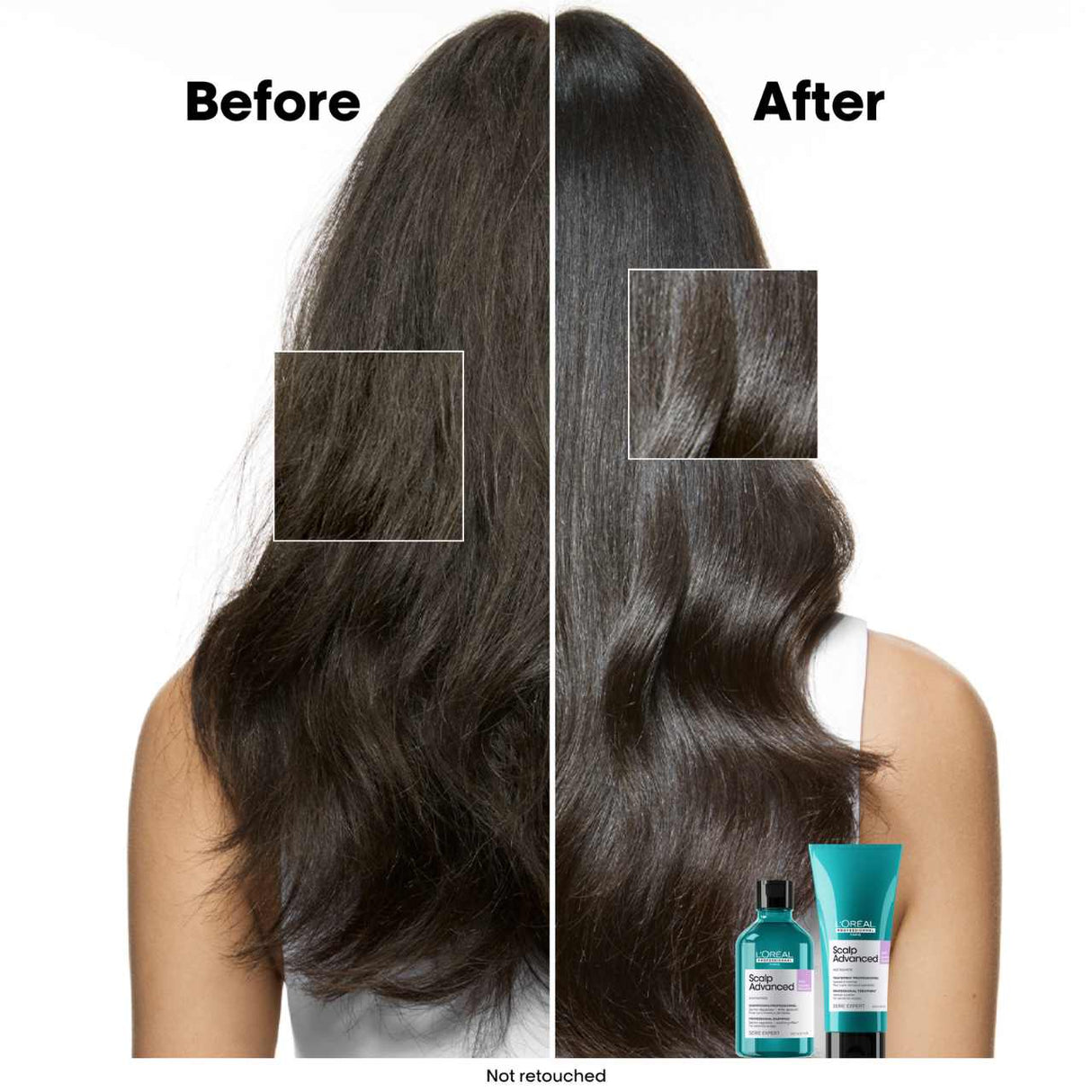 L'Oreal Professionnel Scalp Advanced Anti-Discomfort Shampoo 300ml
