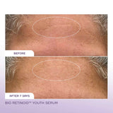 REN Bio Retinoid Youth Serum 30ml