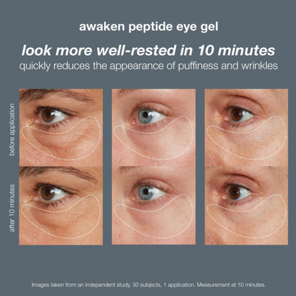 Dermalogica Awaken Peptide Eye Gel 15ml